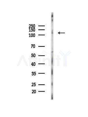 PKD1/PKC mu Antibody - Western blot analysis of lysates from MDA-MB-231 cells(heat-shock,45min treatment), using PKD1/PKC mu Antibody at 1/1000 dilution.