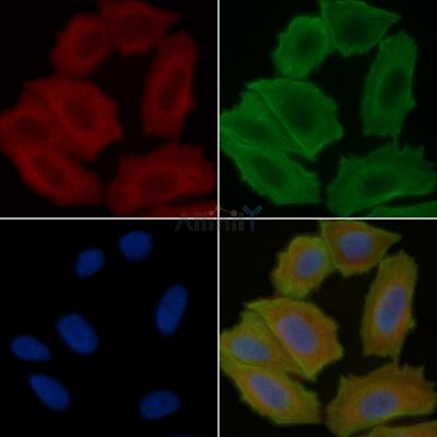PKD1/2/3/PKC mu Antibody - AF6444 staining Hela cells(30min of UV treatment) by IF/ICC.