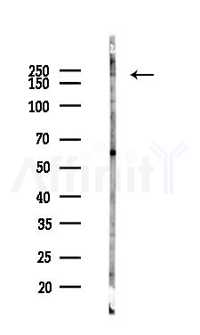HER4 Antibody - Western blot analysis of lysates from Mouse liver, using HER4 Antibody at 1/1000 dilution.