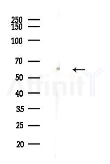 Smad1 Antibody - Western blot analysis of lysates from Hela cells(heat-shock,45min treatment), using Smad1 Antibody at 1/1000 dilution.