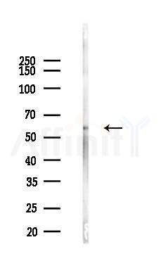 Smad1 Antibody - Western blot analysis of lysates from Mouse liver, using Smad1 Antibody at 1/1000 dilution.