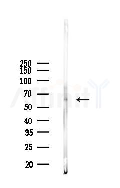 Smad1 Antibody - Western blot analysis of lysates from PC12 cells, using Smad1 Antibody at 1/1000 dilution.
