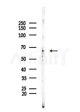 CRMP2 Antibody - Western blot analysis of lysates from PC12 cells, using CRMP2 Antibody at 1/1000 dilution.