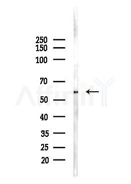 Estrogen Receptor-beta Antibody - Western blot analysis of lysates from Hela cells(heat-shock,45min treatment), using Estrogen Receptor-beta Antibody at 1/1000 dilution.