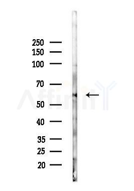 Estrogen Receptor-beta Antibody - Western blot analysis of lysates from Mouse testis, using Estrogen Receptor-beta Antibody at 1/1000 dilution.