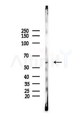 Estrogen Receptor-beta Antibody - Western blot analysis of lysates from PC12 cells, using Estrogen Receptor-beta Antibody at 1/1000 dilution.