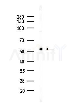 HDAC2 Antibody - Western blot analysis of lysates from Hela cells(heat-shock,45min treatment), using HDAC2 Antibody at 1/1000 dilution.