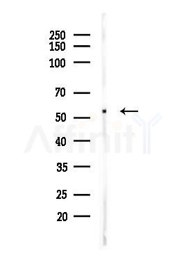 HDAC2 Antibody - Western blot analysis of lysates from LoVo cells(heat-shock,45min treatment), using HDAC2 Antibody at 1/1000 dilution.