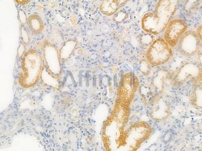 p62Dok Antibody - AF6478 at 1/100 staining human normal kidney tissue by IHC-P.