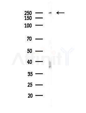WNK1 Antibody - Western blot analysis of lysates from Hela cells(heat-shock,45min treatment), using WNK1 Antibody at 1/1000 dilution.
