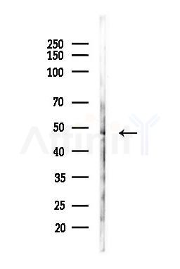 IKK gamma Antibody - Western blot analysis of lysates from LoVo cells(heat-shock,45min treatment), using IKK gamma Antibody at 1/1000 dilution.