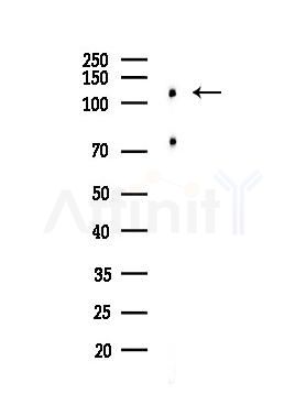MORC2 Antibody - Western blot analysis of lysates from Hela cells(heat-shock,45min treatment), using MORC2 Antibody at 1/1000 dilution.