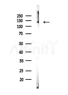 MORC2 Antibody - Western blot analysis of lysates from Mouse testis, using MORC2 Antibody at 1/1000 dilution.