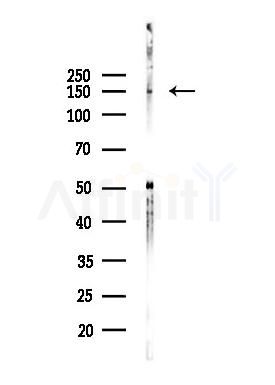 KDM3A Antibody - Western blot analysis of lysates from Hela cells(heat-shock,45min treatment), using KDM3A Antibody at 1/1000 dilution.