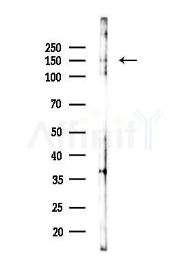 KDM3A Antibody - Western blot analysis of lysates from Mouse testis, using KDM3A Antibody at 1/1000 dilution.