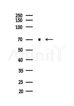 SAMHD1 Antibody - Western blot analysis of lysates from LoVo cells(heat-shock,45min treatment), using SAMHD1 Antibody at 1/1000 dilution.
