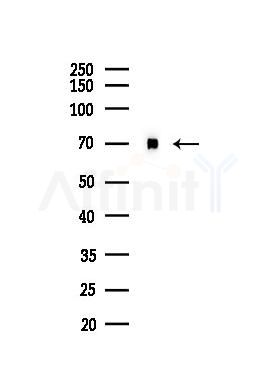 SAMHD1 Antibody - Western blot analysis of lysates from Hela cells(heat-shock,45min treatment), using SAMHD1 Antibody at 1/1000 dilution.