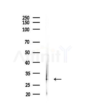 Calsenilin/KCNIP3 Antibody - Western blot analysis of lysates from LoVo cells(heat-shock,45min treatment), using Calsenilin/KCNIP3 Antibody at 1/1000 dilution.