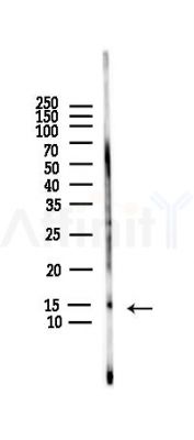PIN4 Antibody - Western blot analysis of lysates from HUVEC cells(LPS,4h treatment), using PIN4 Antibody at 1/1000 dilution.