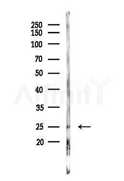 TMS1/ASC Antibody - Western blot analysis of lysates from LoVo cells(heat-shock,45min treatment), using TMS1/ASC Antibody at 1/1000 dilution.