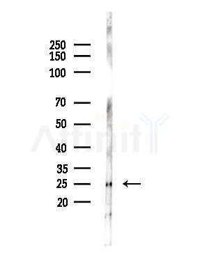 TMS1/ASC Antibody - Western blot analysis of lysates from Hela cells(heat-shock,45min treatment), using TMS1/ASC Antibody at 1/1000 dilution.