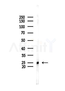 TMS1/ASC Antibody - Western blot analysis of lysates from PC12 cells, using TMS1/ASC Antibody at 1/1000 dilution.