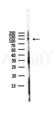 GABBR1 Antibody - Western blot analysis of lysates from PC12 cells(LPS,4h treatment), using GABBR1 Antibody at 1/1000 dilution.