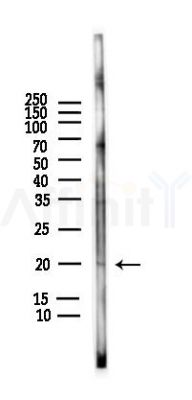 TOMM22 Antibody - Western blot analysis of lysates from HUVEC cells(LPS,4h treatment), using TOMM22 Antibody at 1/1000 dilution.