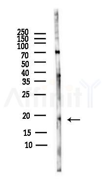TOMM22 Antibody - Western blot analysis of lysates from Rat brain, using TOMM22 Antibody at 1/1000 dilution.