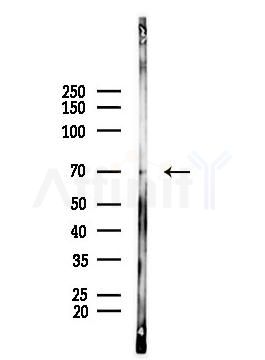 SPHK2 Antibody - Western blot analysis of lysates from PC12 cells, using SPHK2 Antibody at 1/1000 dilution.