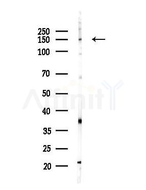 SIK2 Antibody - Western blot analysis of lysates from Hela cells(heat-shock,45min treatment), using SIK2 Antibody at 1/1000 dilution.
