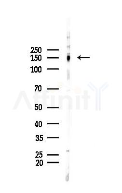 SIK2 Antibody - Western blot analysis of lysates from PC12 cells, using SIK2 Antibody at 1/1000 dilution.