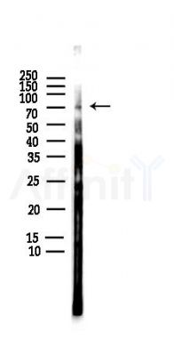 MAP3K3 Antibody - Western blot analysis of lysates from HUVEC cells(LPS,4h treatment), using MAP3K3 Antibody at 1/1000 dilution.