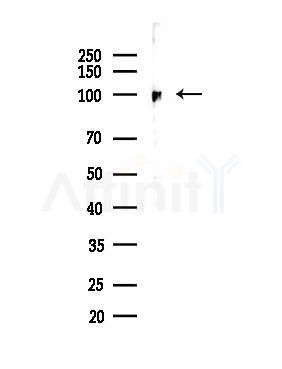 UHRF1 Antibody - Western blot analysis of lysates from LoVo cells(heat-shock,45min treatment), using UHRF1 Antibody at 1/1000 dilution.