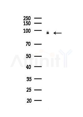 UHRF1 Antibody - Western blot analysis of lysates from Hela cells(heat-shock,45min treatment), using UHRF1 Antibody at 1/1000 dilution.