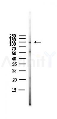 NLRP3 Antibody - Western blot analysis of lysates from PC12 cells(LPS,4h treatment), using NLRP3 Antibody at 1/1000 dilution.