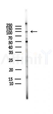 NLRP3 Antibody - Western blot analysis of lysates from HUVEC cells(LPS,4h treatment), using NLRP3 Antibody at 1/1000 dilution.