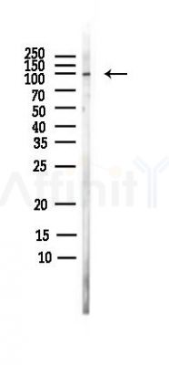 NLRP3 Antibody - Western blot analysis of lysates from Rat brain, using NLRP3 Antibody at 1/1000 dilution.