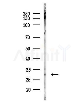 OTUB1 Antibody - Western blot analysis of lysates from Hela cells(heat-shock,45min treatment), using OTUB1 Antibody at 1/1000 dilution.