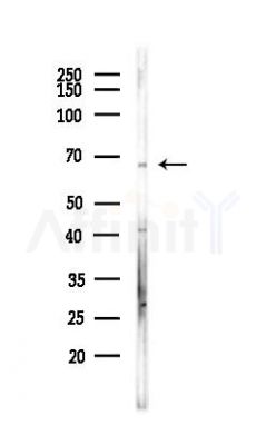 BLNK Antibody - Western blot analysis of lysates from HUVEC cells(LPS,4h treatment), using BLNK Antibody at 1/1000 dilution.