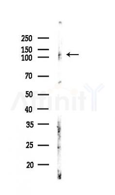 NLRC4 Antibody - Western blot analysis of lysates from LoVo cells(heat-shock,45min treatment), using NLRC4 Antibody at 1/1000 dilution.