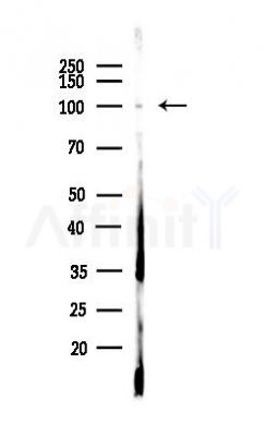 EZH2 Antibody - Western blot analysis of lysates from HUVEC cells(LPS,4h treatment), using EZH2 Antibody at 1/1000 dilution.