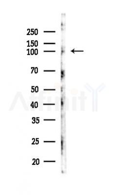 EZH2 Antibody - Western blot analysis of lysates from LoVo cells(heat-shock,45min treatment), using EZH2 Antibody at 1/1000 dilution.