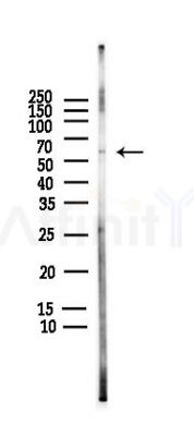 IRF5 Antibody - Western blot analysis of lysates from HUVEC cells(LPS,4h treatment), using IRF5 Antibody at 1/1000 dilution.
