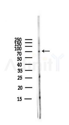 PAK1 Antibody - Western blot analysis of lysates from PC12 cells(LPS,4h treatment), using PAK1 Antibody at 1/1000 dilution.