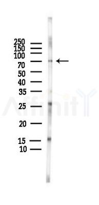 PAK1 Antibody - Western blot analysis of lysates from HUVEC cells(LPS,4h treatment), using PAK1 Antibody at 1/1000 dilution.