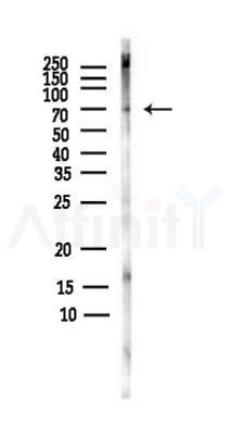 PAK1 Antibody - Western blot analysis of lysates from Rat brain, using PAK1 Antibody at 1/1000 dilution.