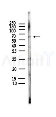 SLC1A5 Antibody - Western blot analysis of lysates from HUVEC cells(LPS,4h treatment), using SLC1A5 Antibody at 1/1000 dilution.