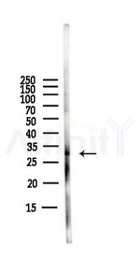 CDK5 Antibody - Western blot analysis of lysates from PC12 cells(LPS,4h treatment), using CDK5 Antibody at 1/1000 dilution.