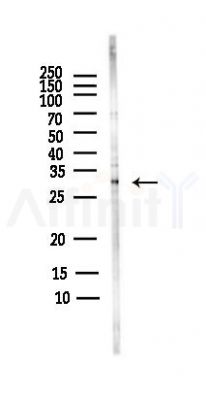 CDK5 Antibody - Western blot analysis of lysates from Rat brain, using CDK5 Antibody at 1/1000 dilution.